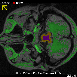 Untere Hüllenbegrenzung